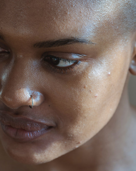 The Normalcy of Visible Pores : A Guide