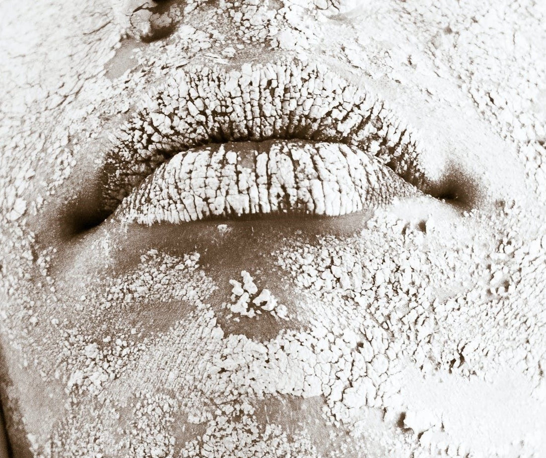 Dry Skin -10 Tips to Start The Year